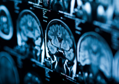 The X-ray of the human brain closeup image